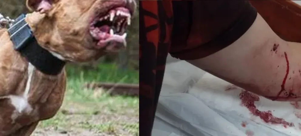 Una familia sufrió el ataque de una jauría de perros pitbull 