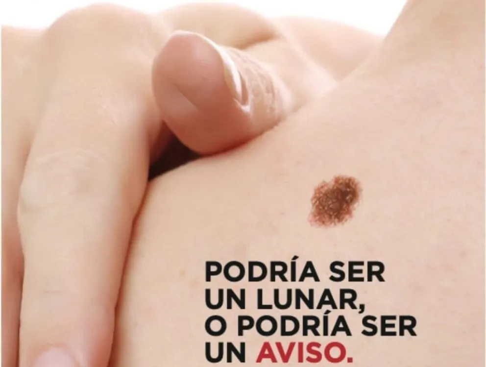 VIDEO: Cipolletti se suma a la campaña nacional de prevención de cáncer de piel