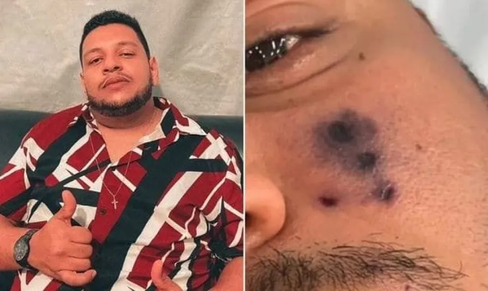 Terrible: un cantante de Brasil murió por la picadura de una araña letal