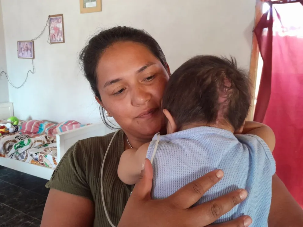 Papá le salvó la vida a su bebé en un accidente doméstico y hoy necesitan ayuda urgente