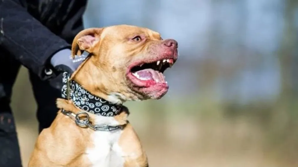 Una nena de 9 años se encuentra en estado crítico tras ser atacada por un pitbull