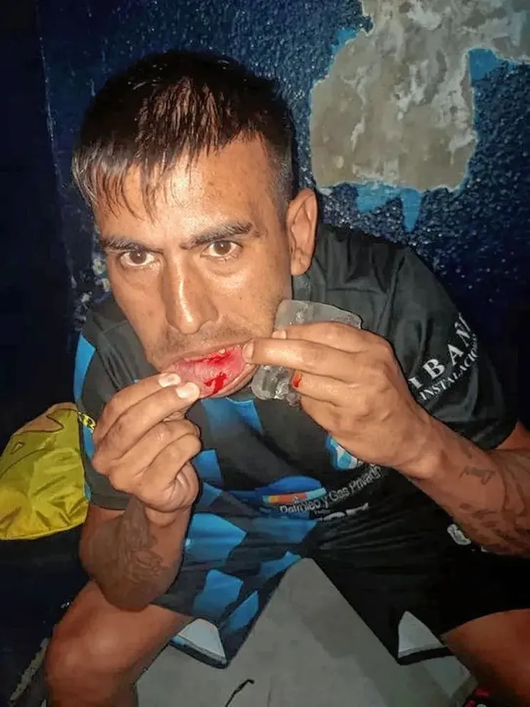 Escándalo: “liberaron” el tunel y agredieron a los jugadores visitantes
