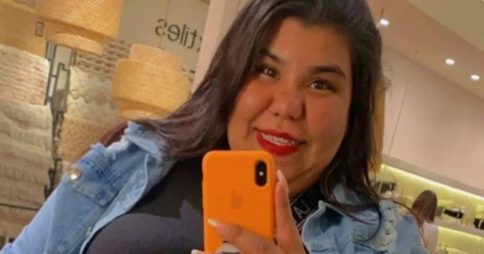 Impactantes cambios en Camila, la hermana de Thiago de GH, tras un tratamiento estético