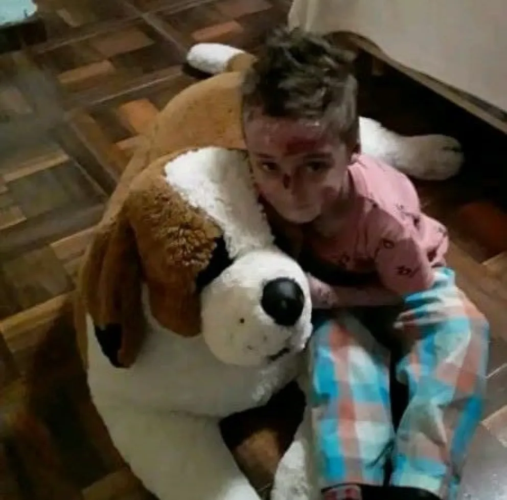 Organizaron una rifa para colaborar con Noah, el niño con piel de cristal