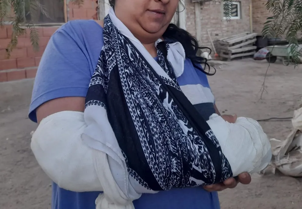 VIDEO. Un Dios aparte: fue atacada por un Dogo y un Pitbull y terminó con múltiples fracturas