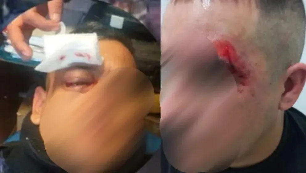 Dos policías resultaron gravemente heridos durante un allanamiento 