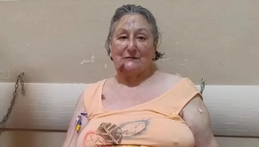 Derrumbe en Gesell: el testimonio de la única sobreviviente hasta ahora
