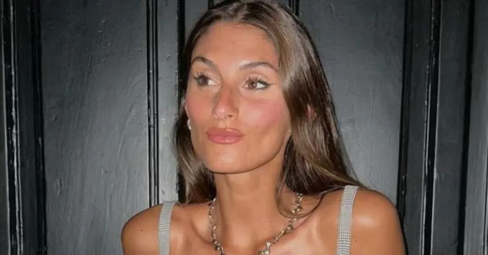 Lola Latorre contó por qué decidió realizarse una cirugía estética en el rostro