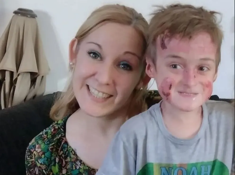 Noah, el chiquito con “piel de cristal”, necesita atención especializada por su ojito