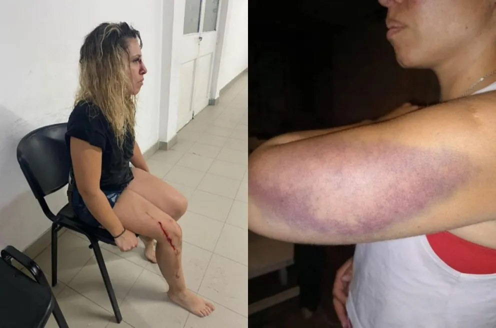Durante el último ataque, la mujer sufrió golpes, patadas y un intento de ahogarla en una pileta de lona. Foto: gentileza.