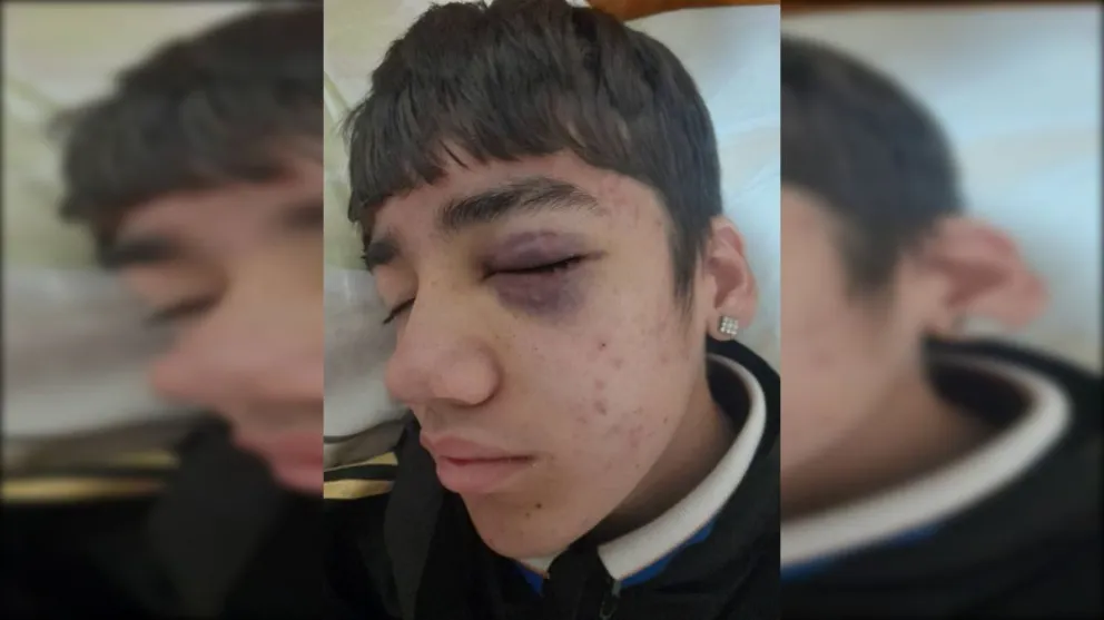 La mamá de la víctima anunció que realizará una denuncia penal para que el hecho no quede en el olvido. Foto: gentileza.