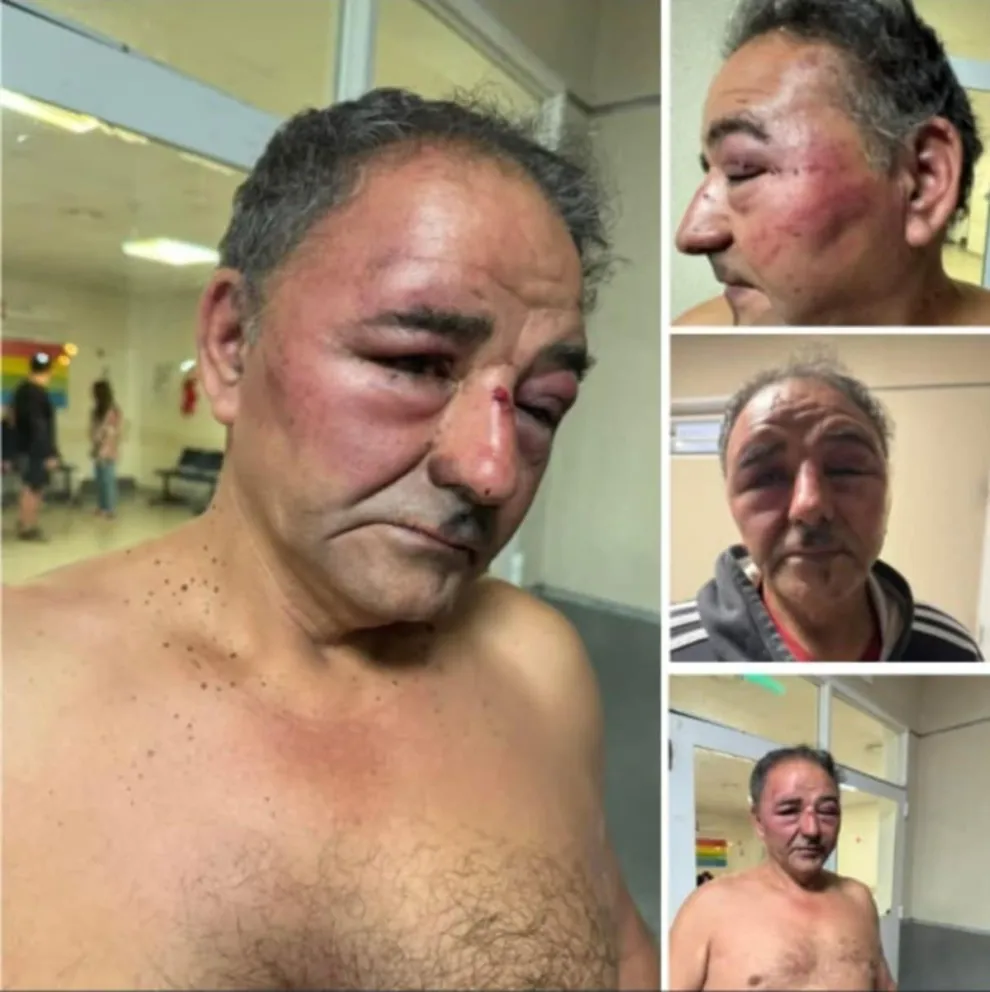 La querella pidió distintas medidas probatorias para demostrar que Hernández fue castigado por efectivos policiales. Denuncian un "secuestro ilegal". Foto: gentileza Catriel25.
