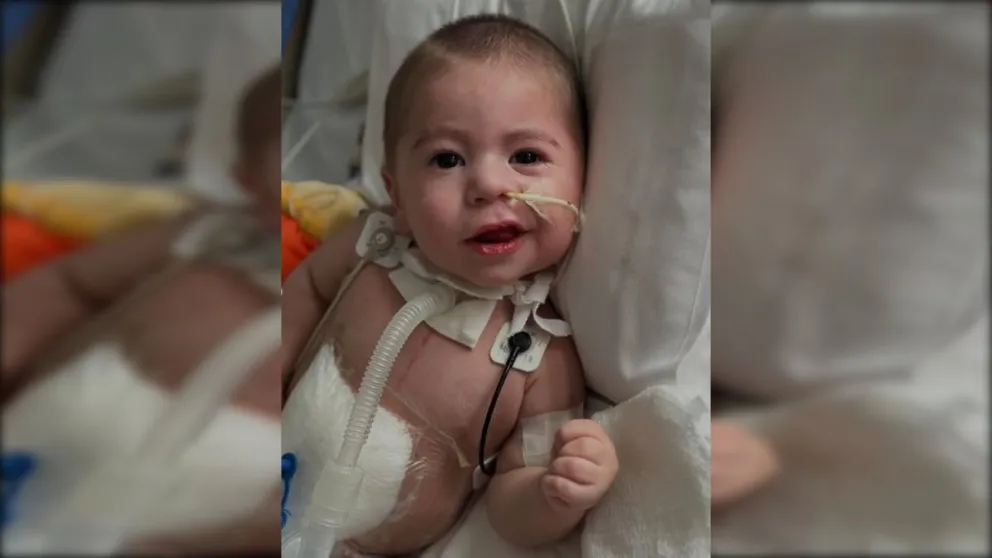 El trasplante fue exitoso y su familia espera ver la evolución del bebé. 