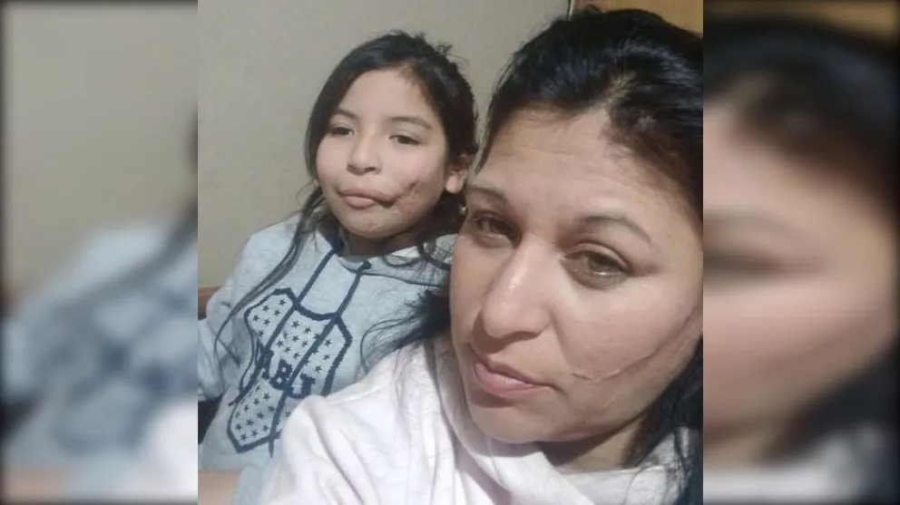 Jade y su mamá, Jessica, viajarán a Buenos Aires para que la niña pueda ser operada de la mejilla. Foto: gentileza.