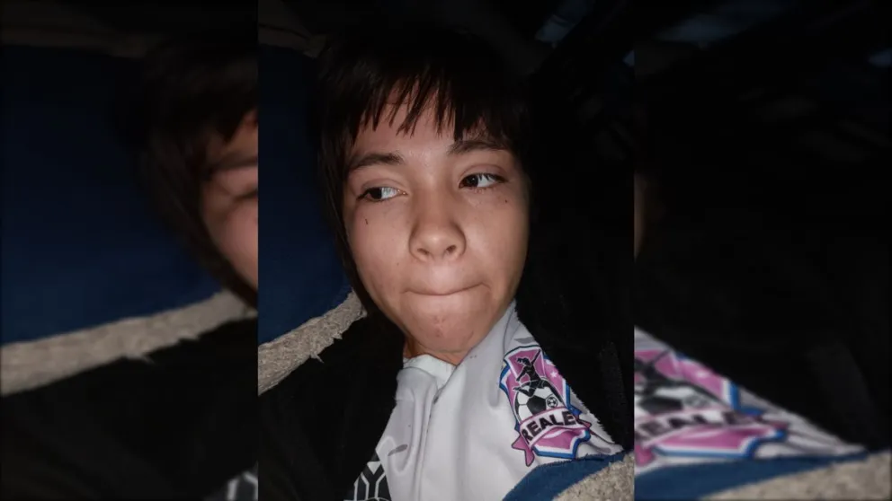 La adolescente subió las imágenes a su red social para mostrar los golpes y la violencia ejercida por su expareja. Foto: del facebook de MM.