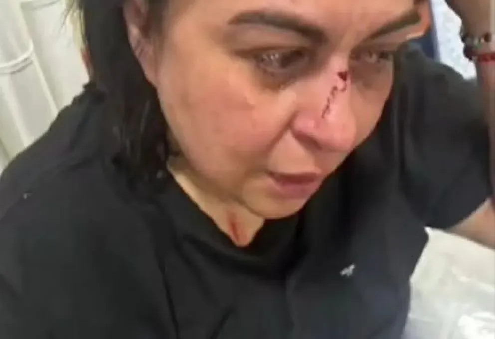 Vanina Lavaccara sufrió lesiones en el rostro y el brazo tras ser agredida en plena vía pública. La docente universitaria fue asistida por vecinos y atendida en un sanatorio local. Foto: gentileza