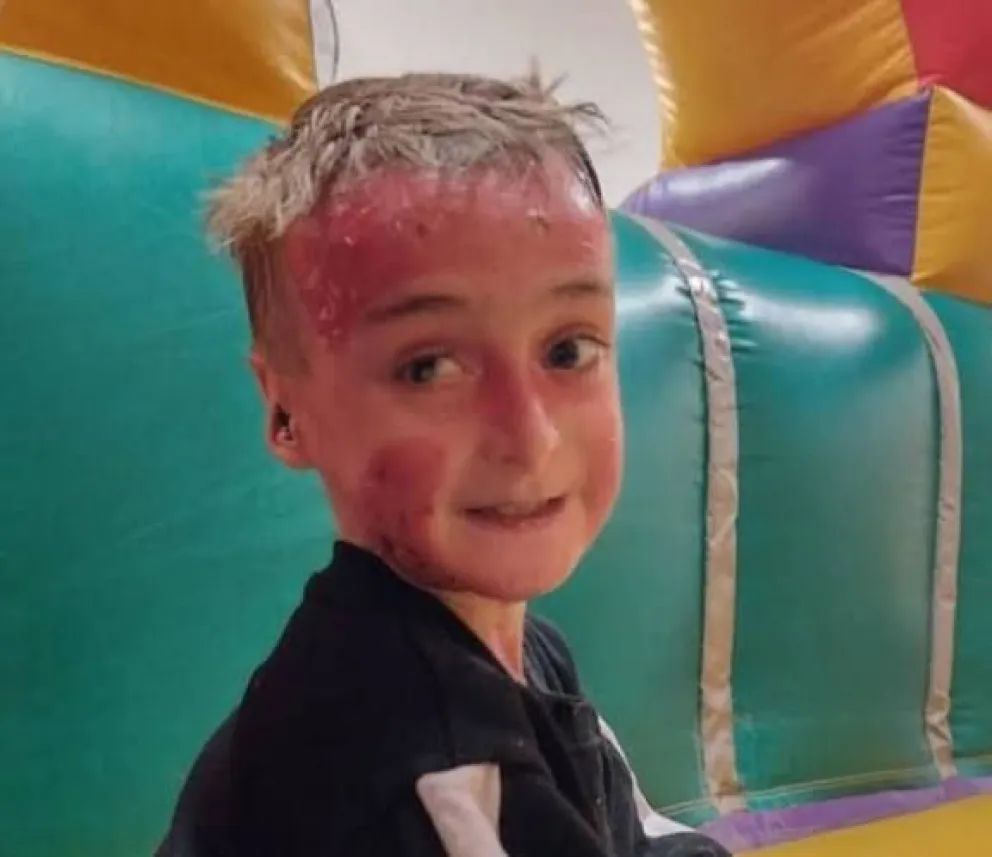 Noah tiene una condición que requiere atención médica constante y especializada.Foto: gentileza