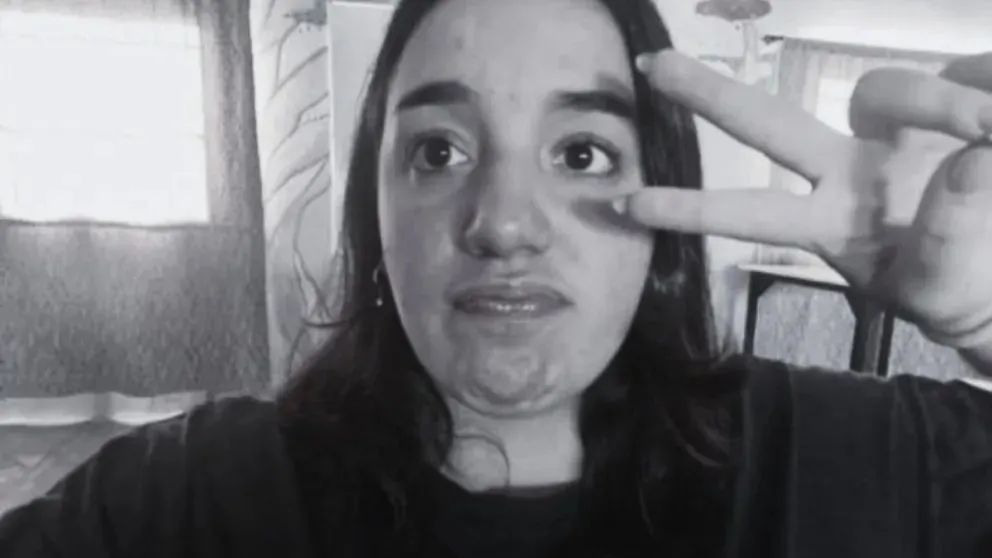 La joven de tan solo 17 años había logrado escapar del auto envuelto en llamas. (Foto gentileza