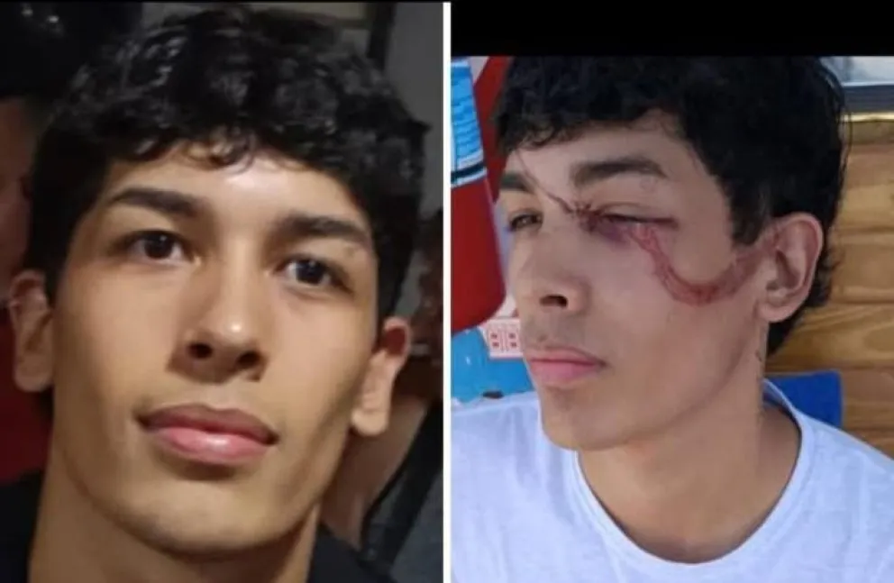 Camilo tiene 19 años y sufrió un accidente cuando fue a lavar su auto a un lavadero. Foto gentileza